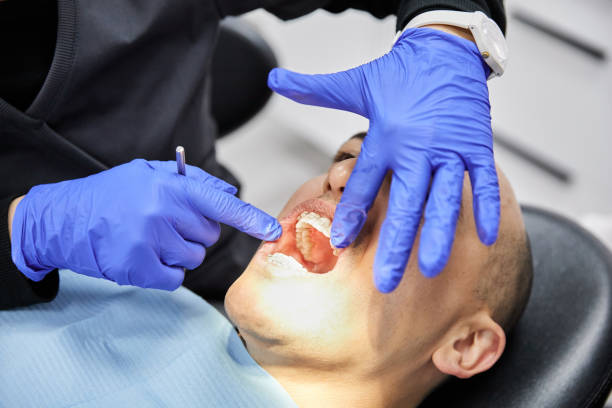 Best Emergency Root Canal Treatment in Stickney, IL